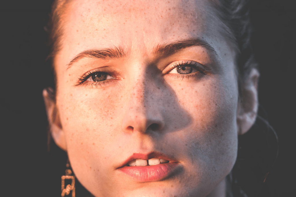 sun damage