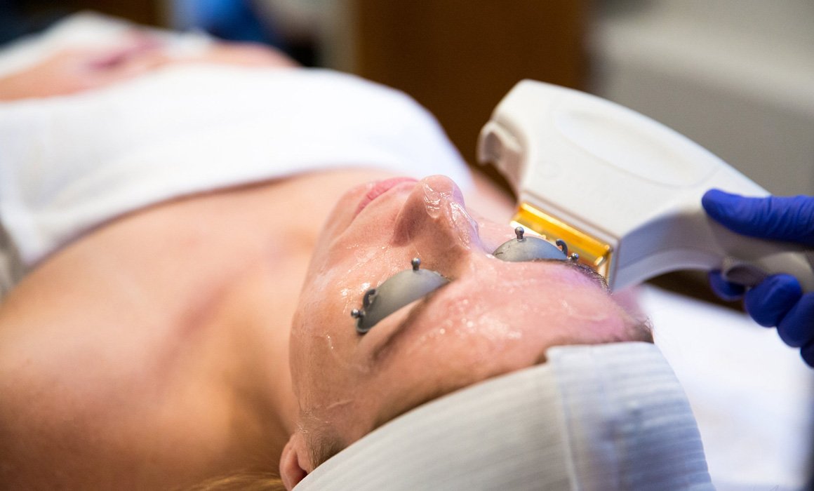 Different Skin Treatment Lasers