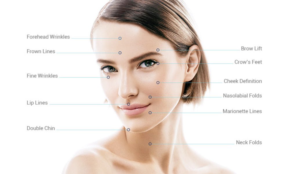 ultraformer skin treatments