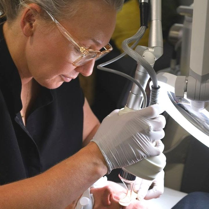 Fractional CO2 laser used by Jodie, dermal clinician