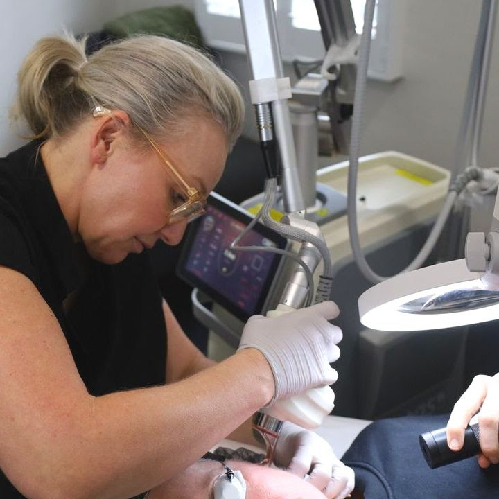 Fractional CO2 laser used by Jodie, dermal clinician