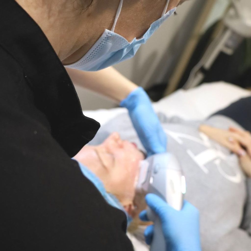 Ultraformer treament on a client by Skin Clinic Blyss Dermal Clinician