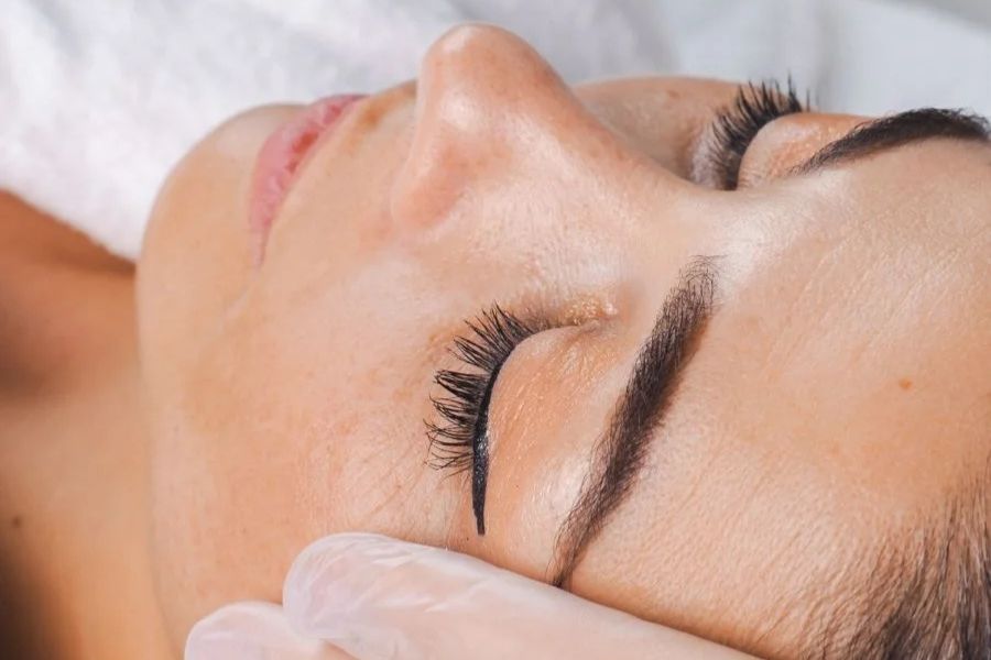 close up of woman receiving BBL Photorejuvenation treatment